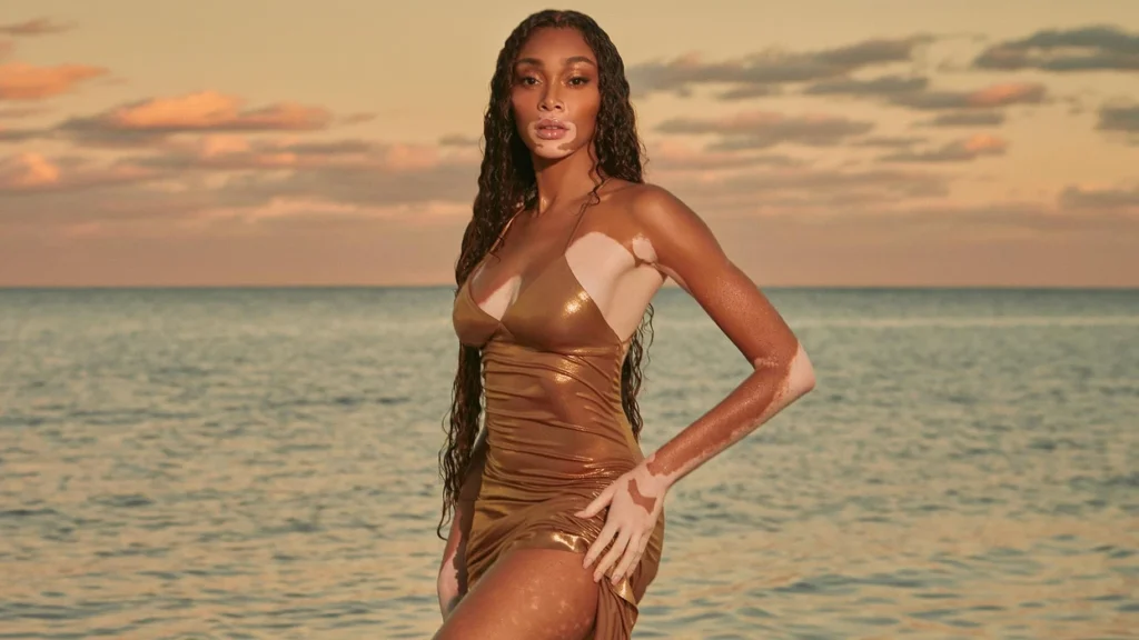 The Impact of Winnie Harlow on the Fashion Industry
