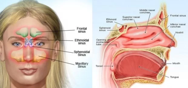 Sinusitis: Cerita dan Cara Saya Menghadapinya Sampai Akhirnya Bisa Lega Lagi